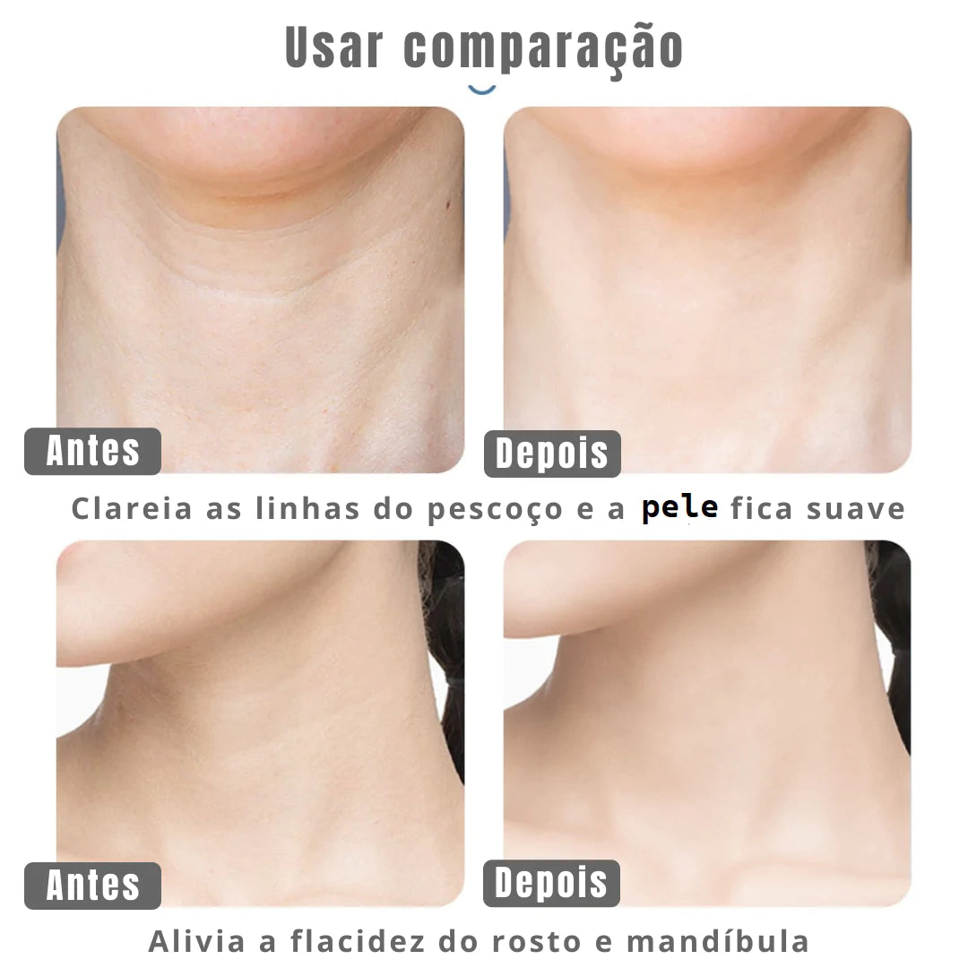 Massageador facial CKEYIN